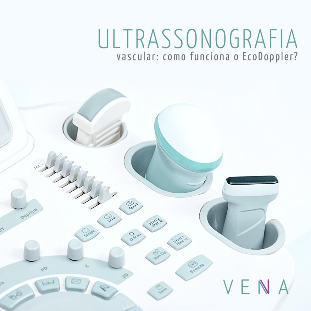 ultrassonografia-vascular
