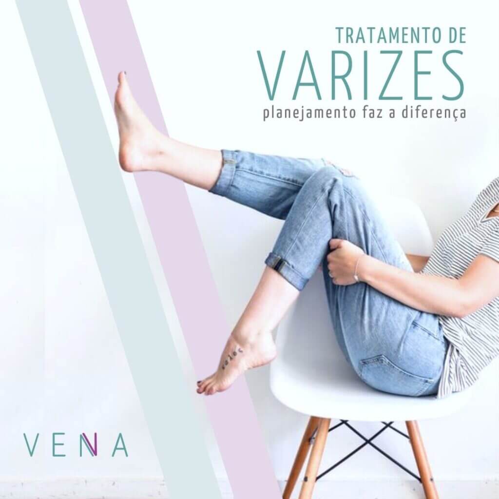 tratamento-de-varizes