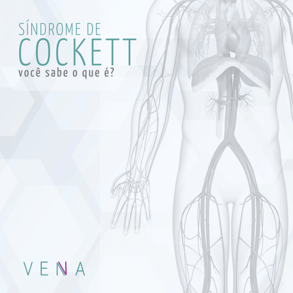 A Síndrome de Cockett dificulta o retorno venoso da perna esquerda para o coração, o que leva à formação de varizes nesse membro.