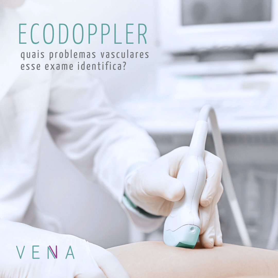 Cirurgião Vascular utilizando o Ecodoppler na pele de um paciente