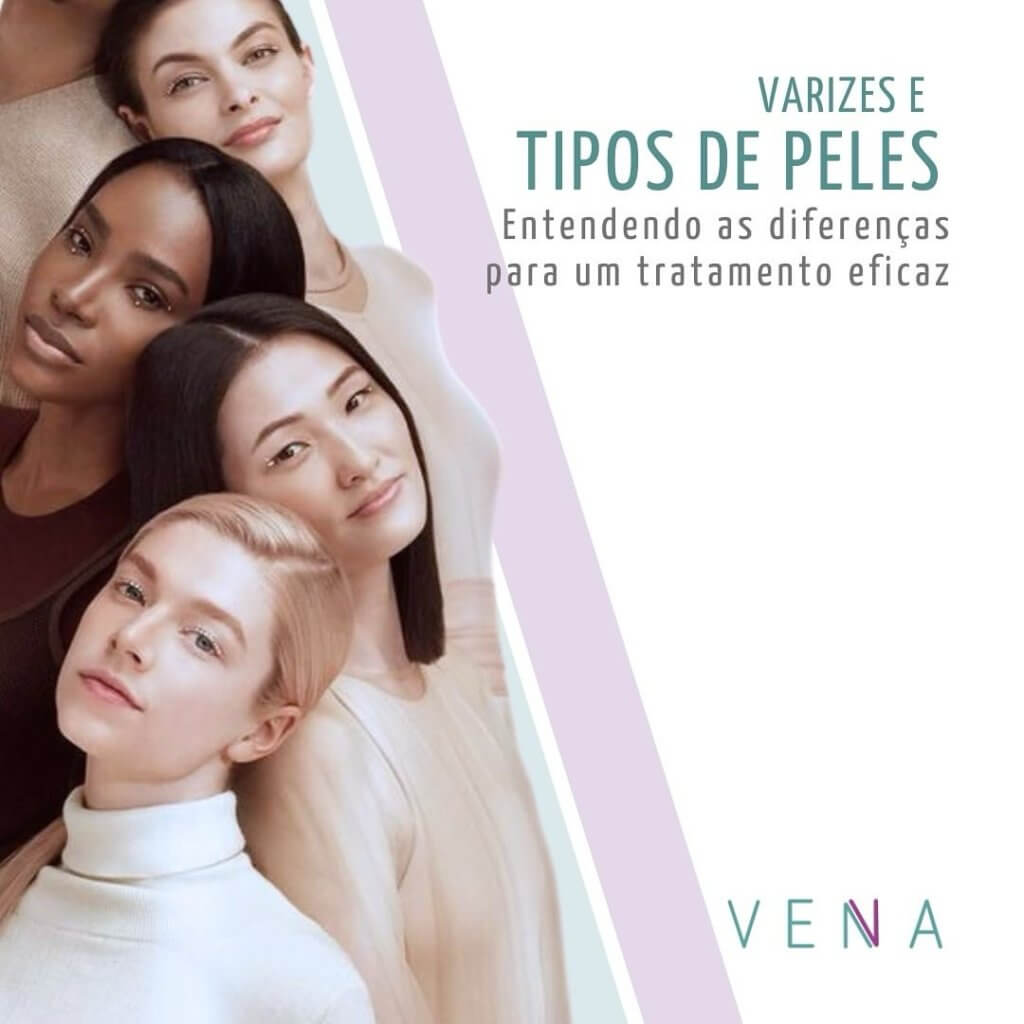 varizes-e-tipos-de-pele