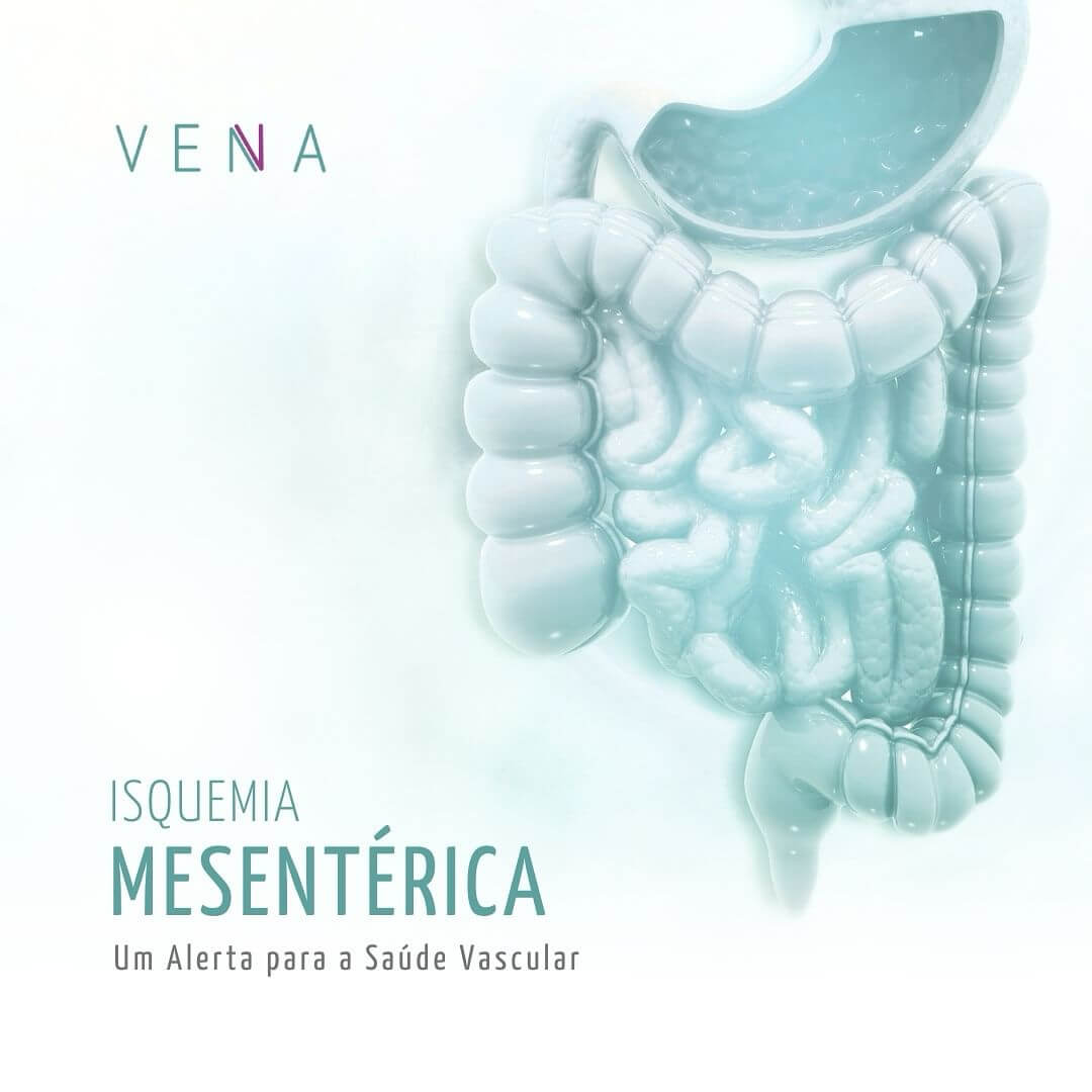 isquemia-mesenterica