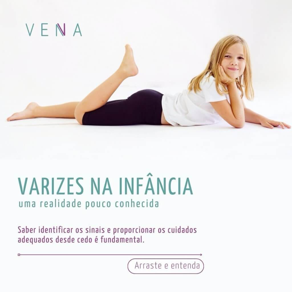 varizes-na-infancia