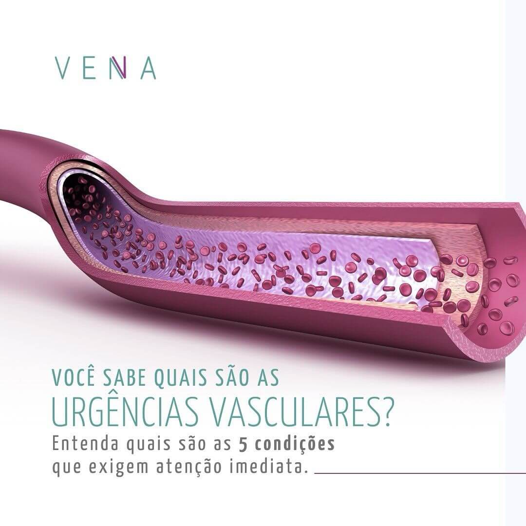 urgencias-vasculares