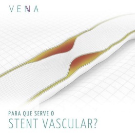 stent-vascular