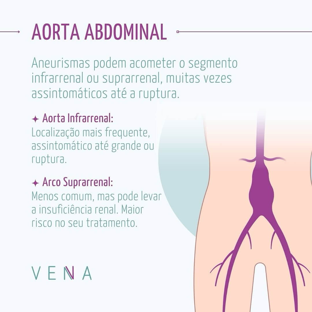 aneurismas-da-aorta