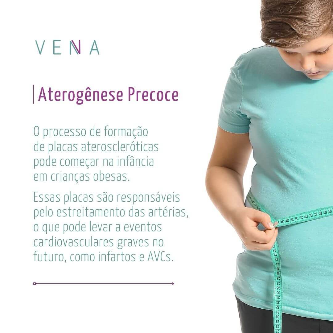 obesidade-infantil-e-saude-vascular