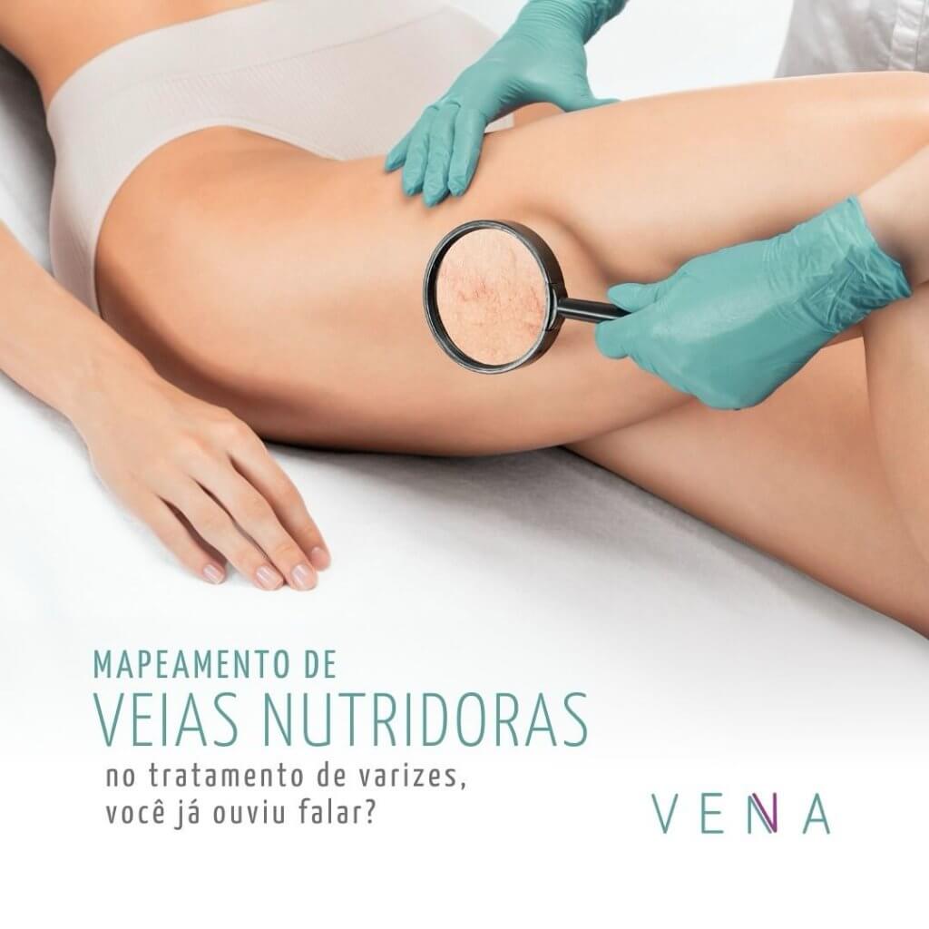 mapeamento-de-veias-nutridoras