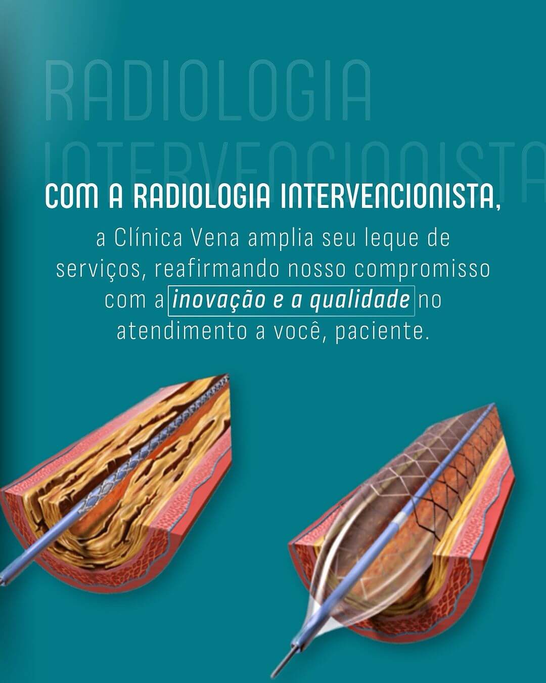 radiologia-intervencionista