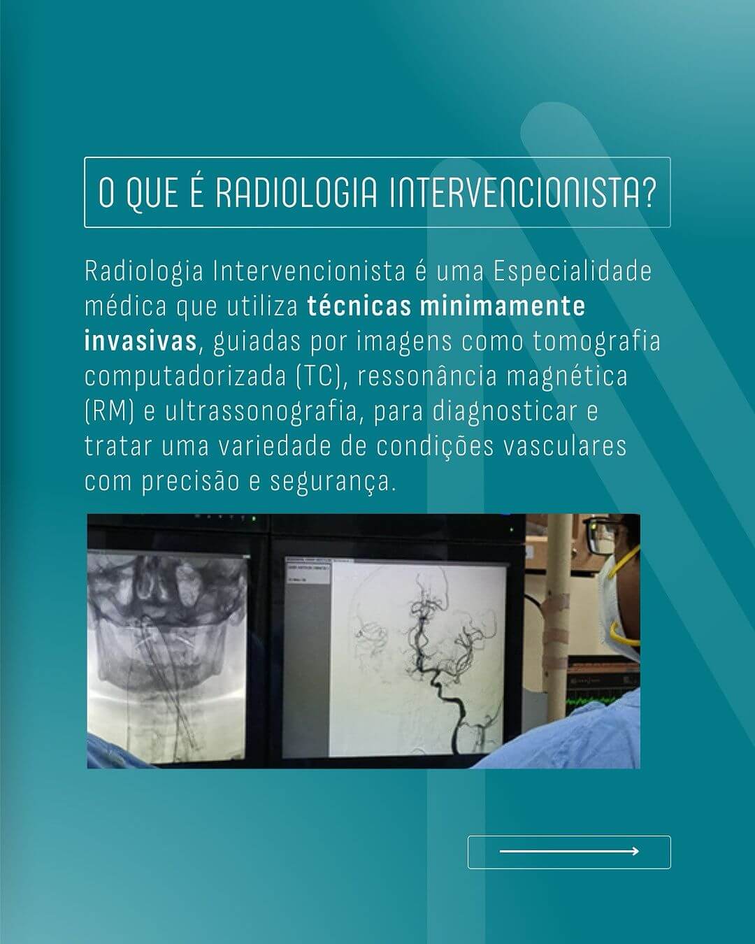 radiologia-intervencionista