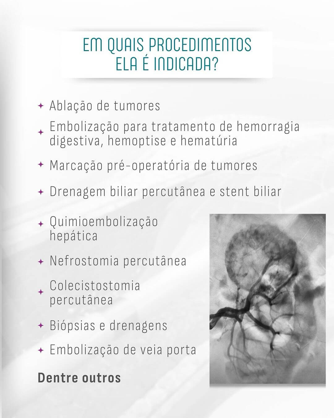 radiologia-intervencionista