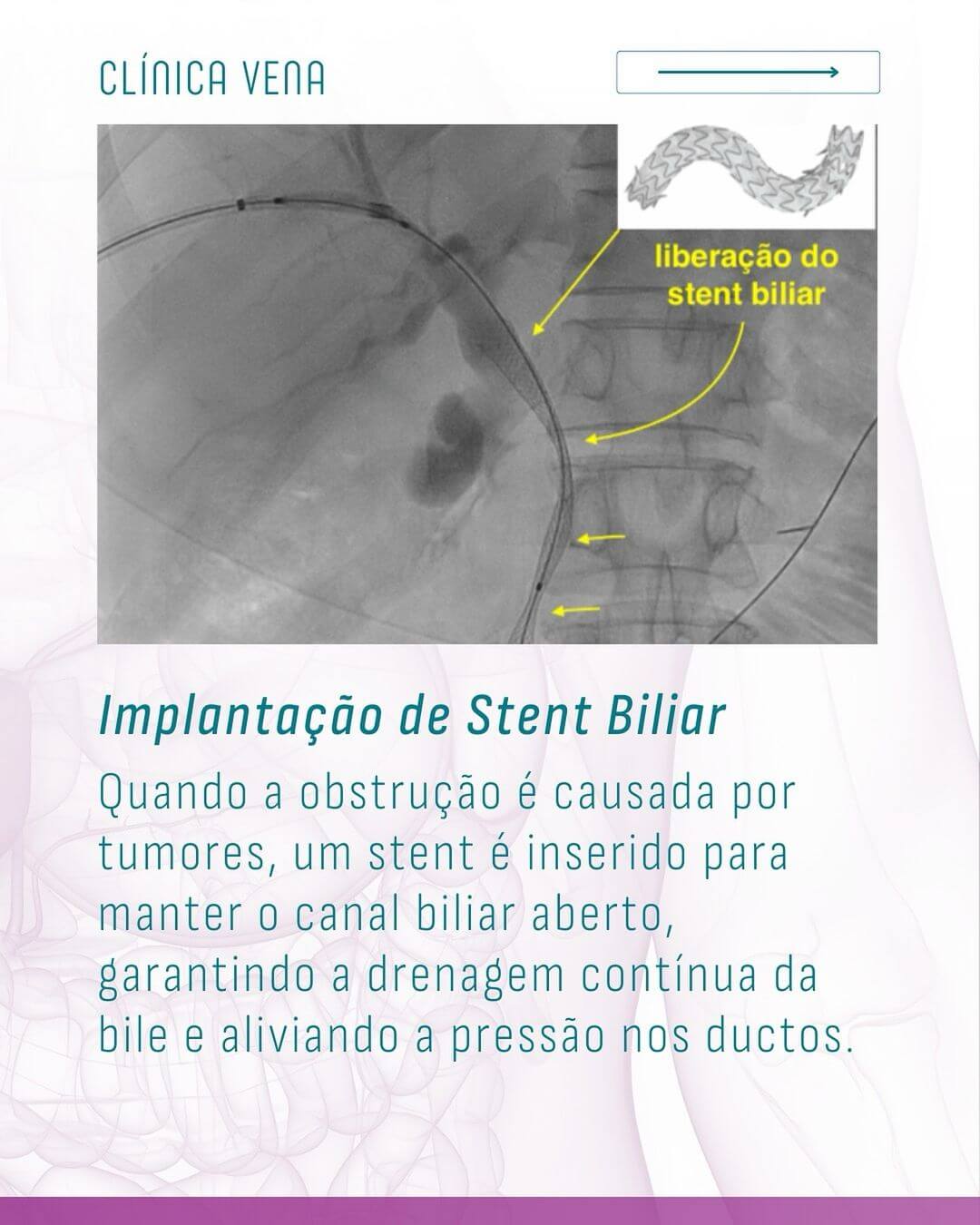 problemas-biliares