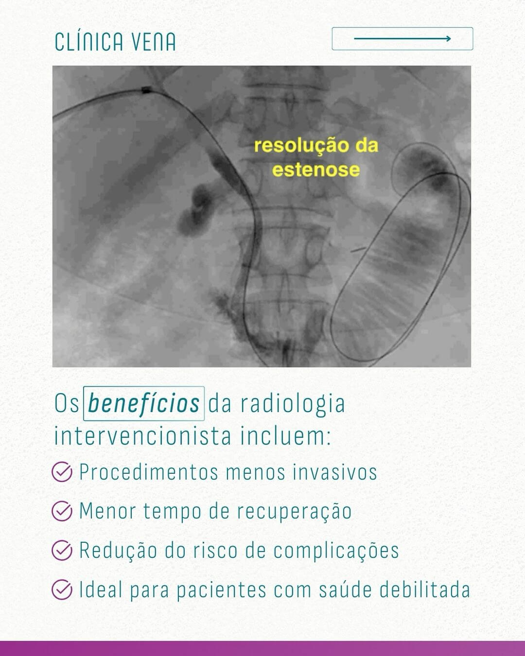 problemas-biliares