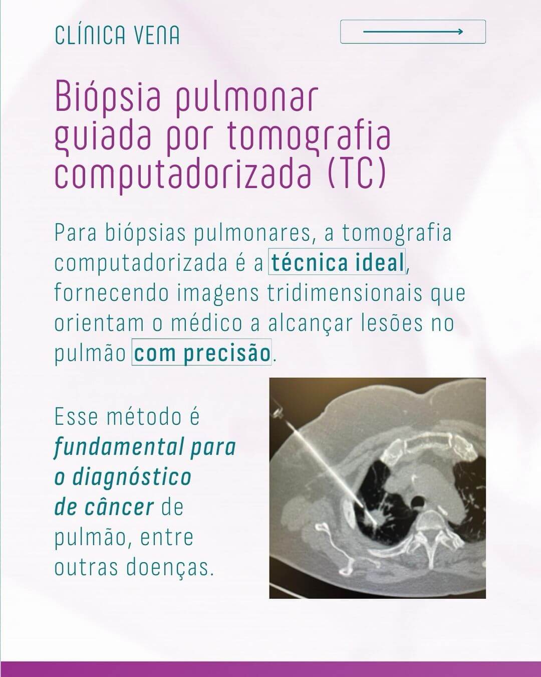 biopsia-guiada-por-imagem