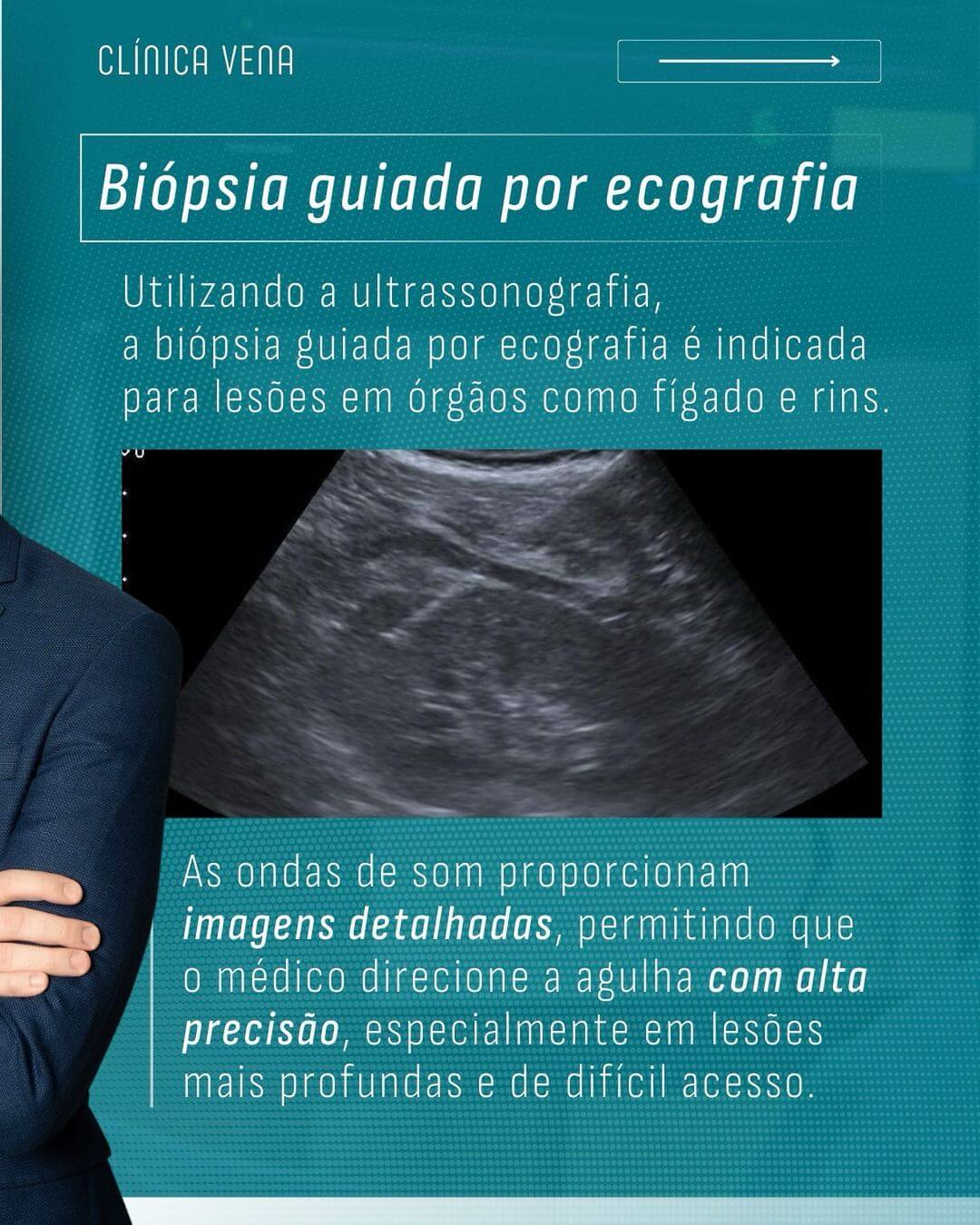 biopsia-guiada-por-imagem