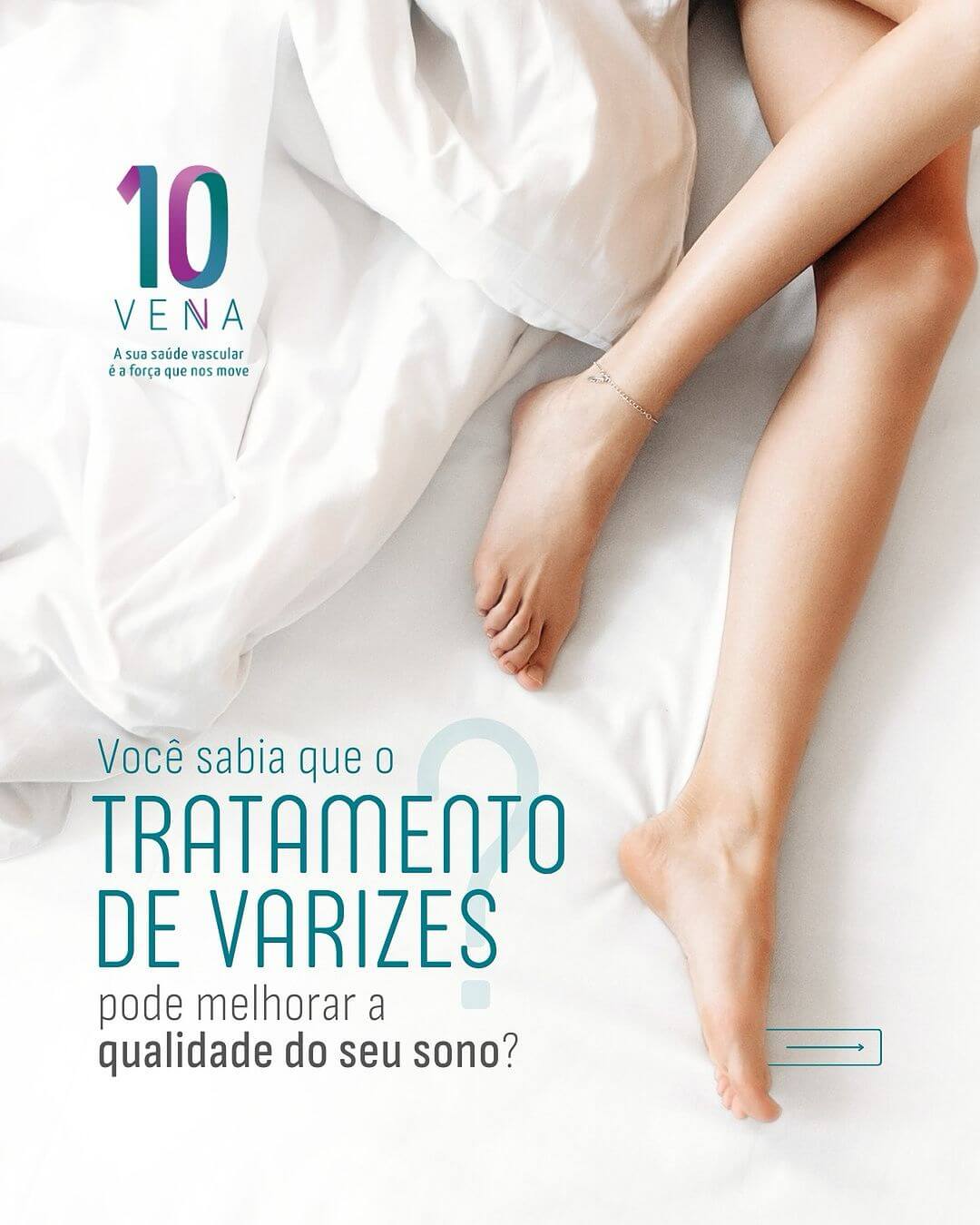 tratamento-de-varizes