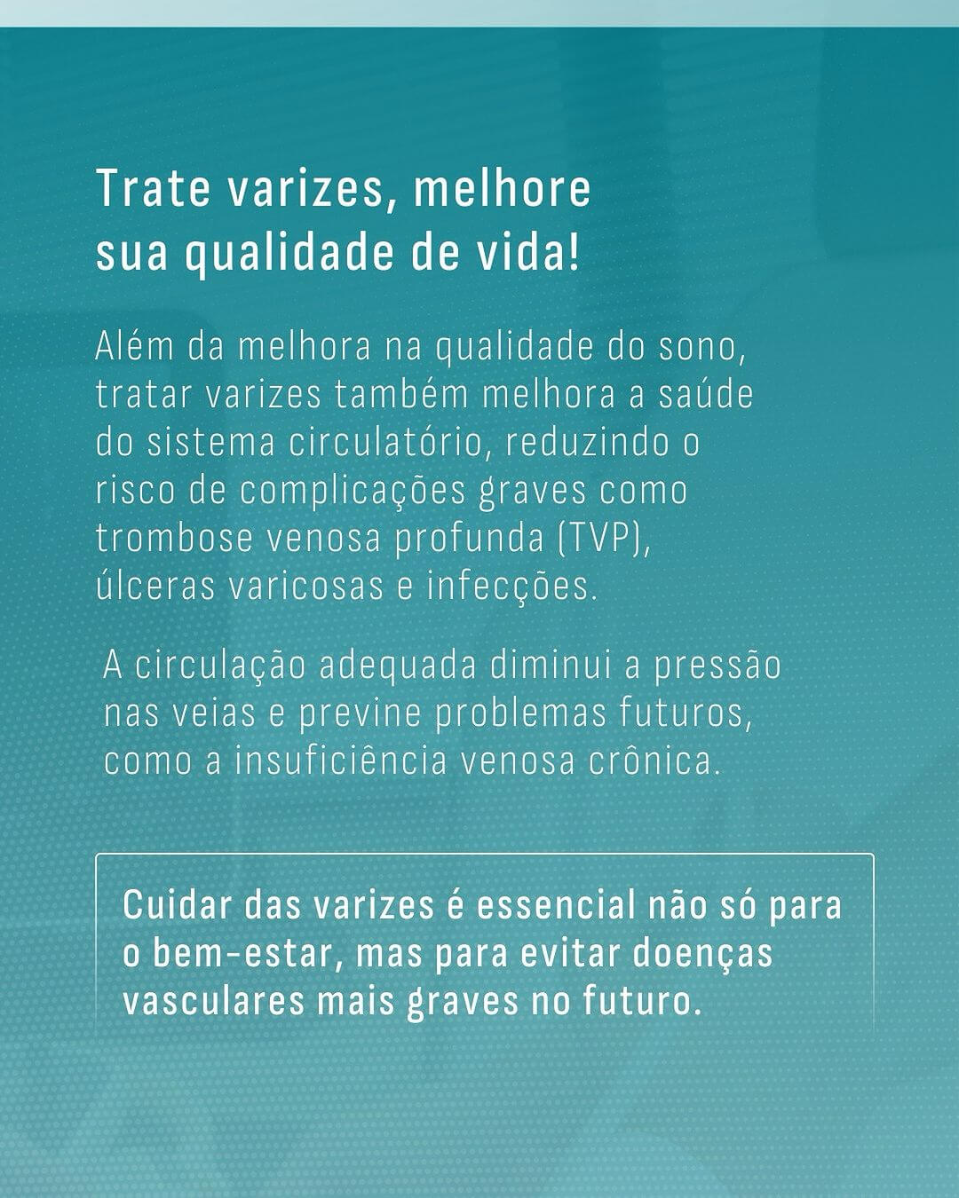 tratamento-de-varizes