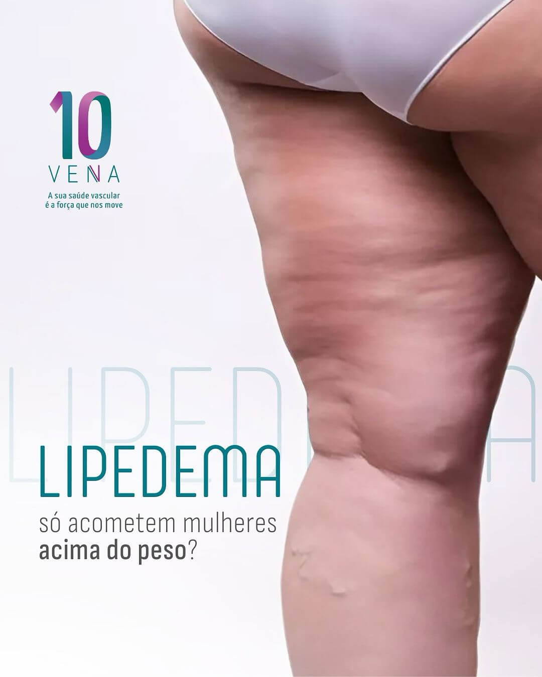 lipedema-e-sobrepeso