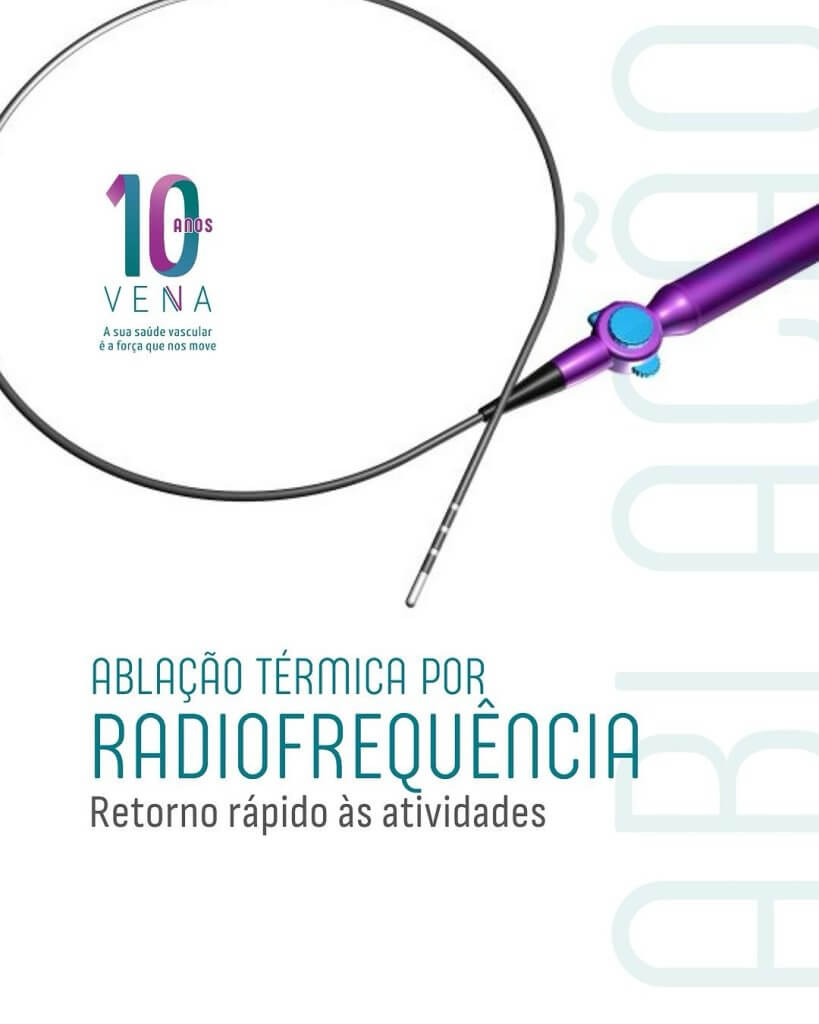 ablacao-termica-por-radiofrequencia