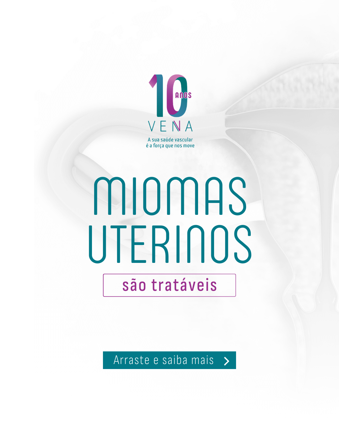 miomas-uterinos