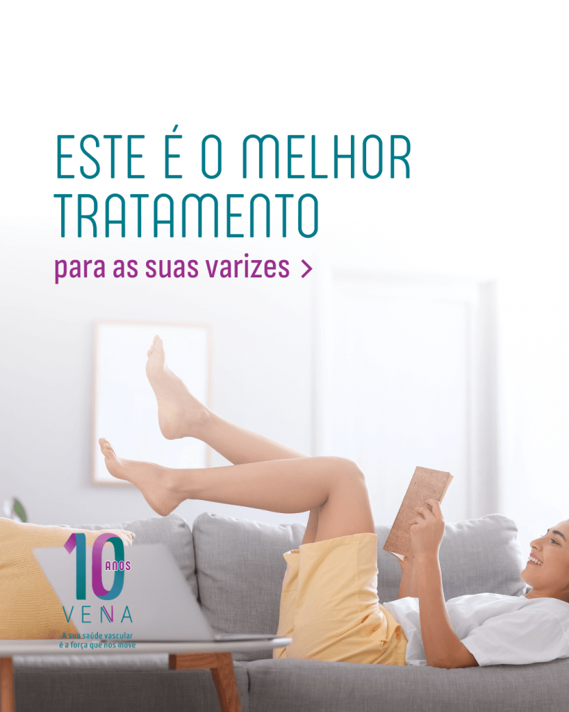 o-tratamento-de-varizes