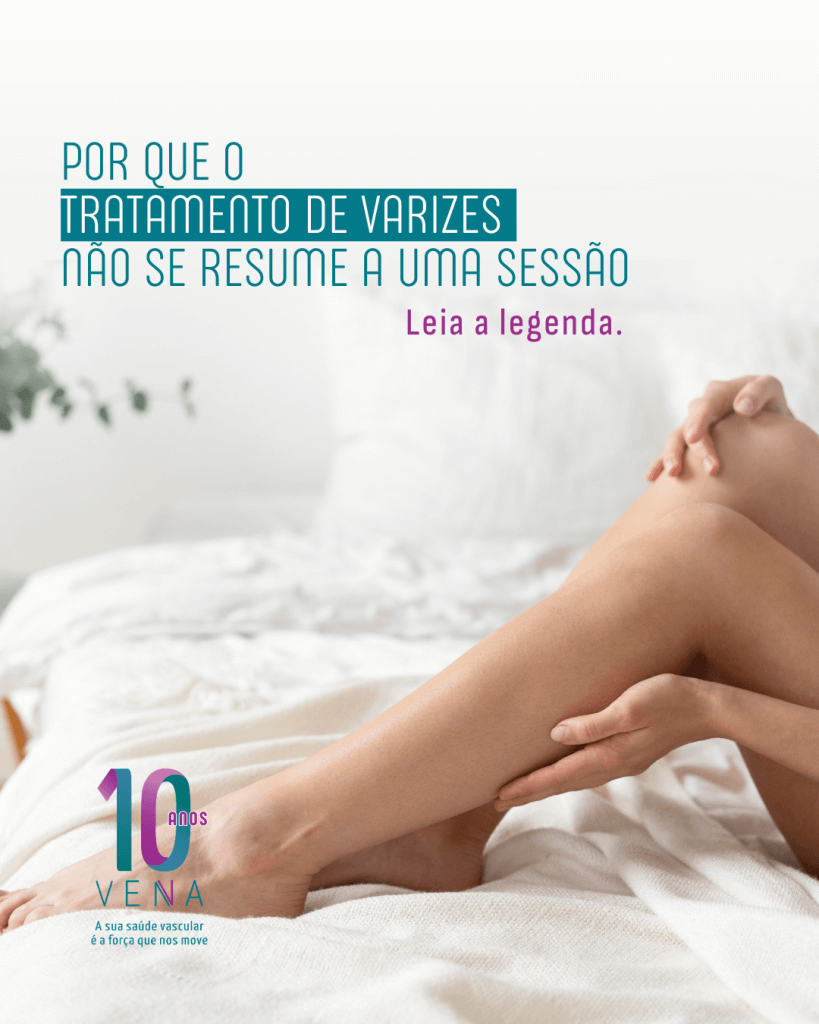 o-tratamento-de-varizes