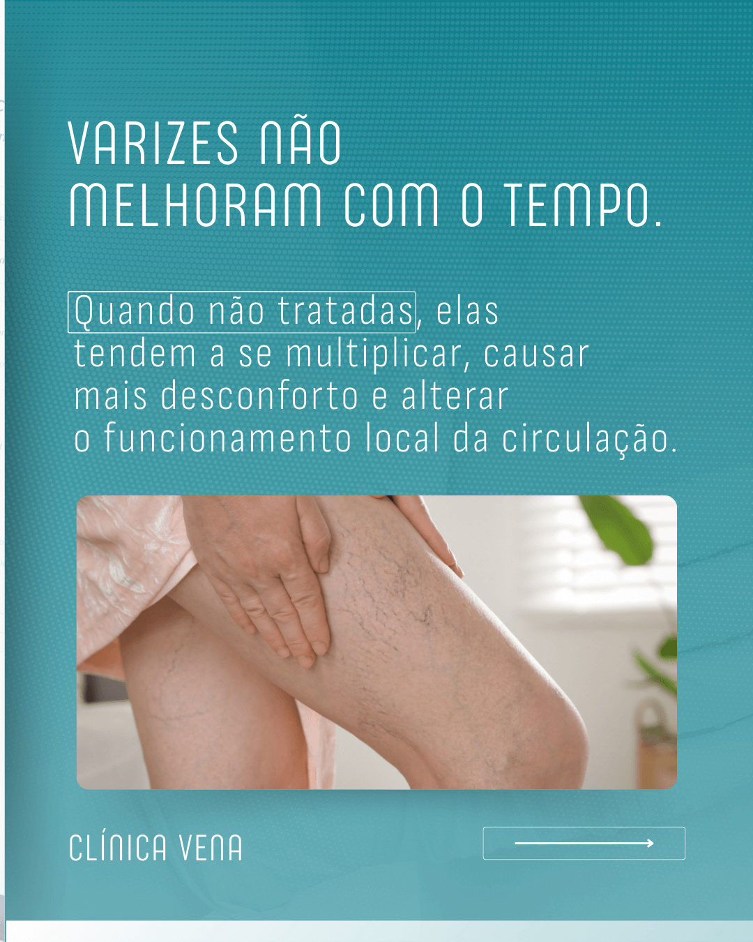 o-tratamento-das-varizes